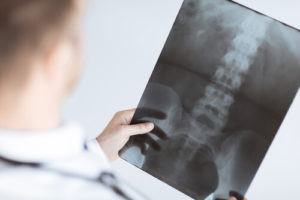 back-injury